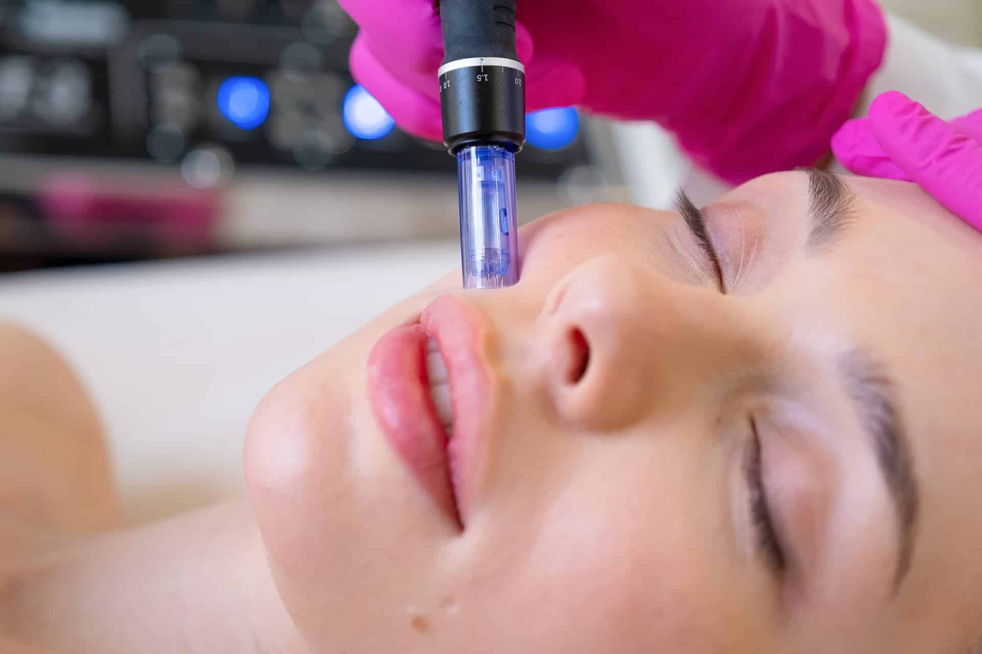 Hidratación con Dermapen
