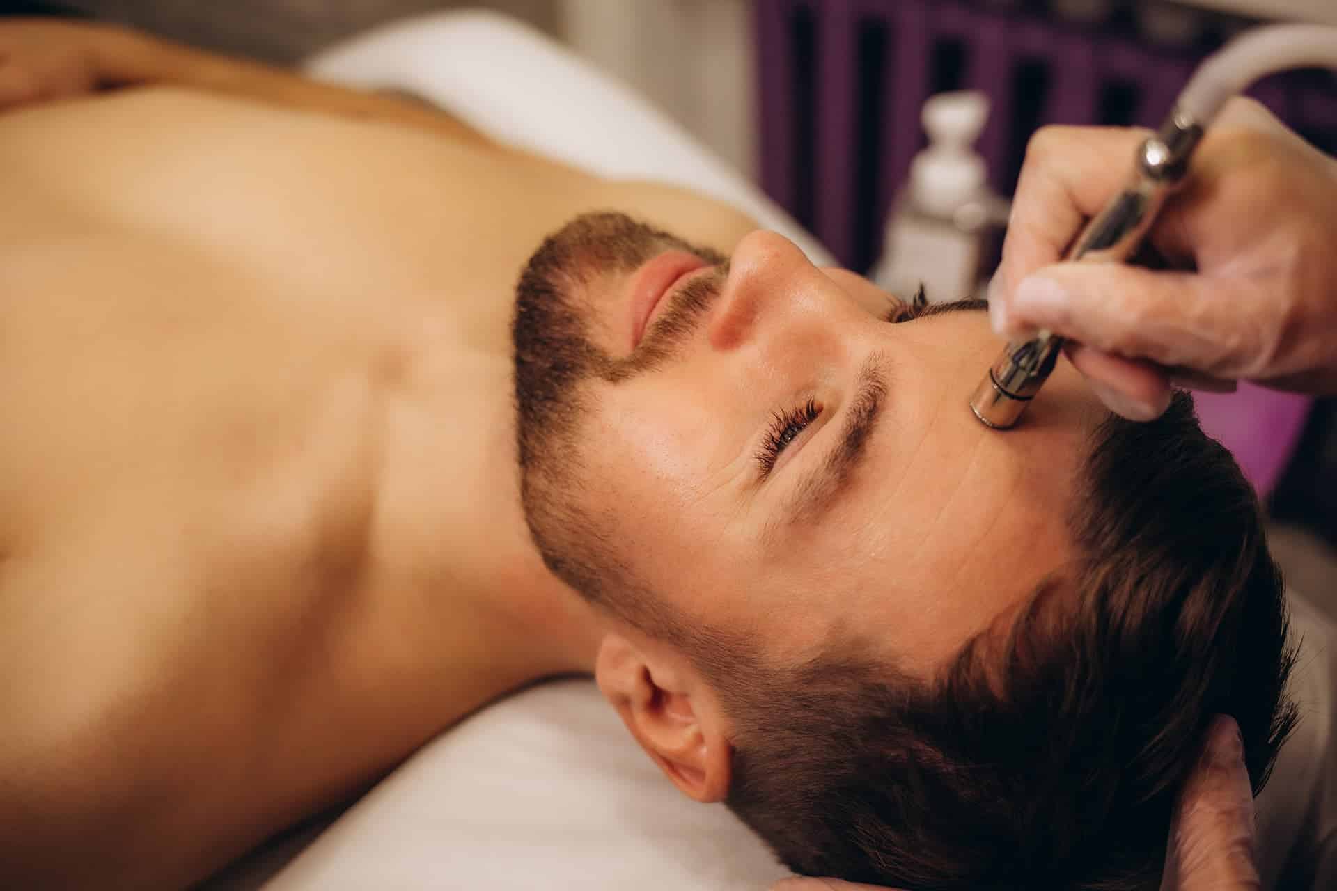 Peeling con Microdermoabrasión